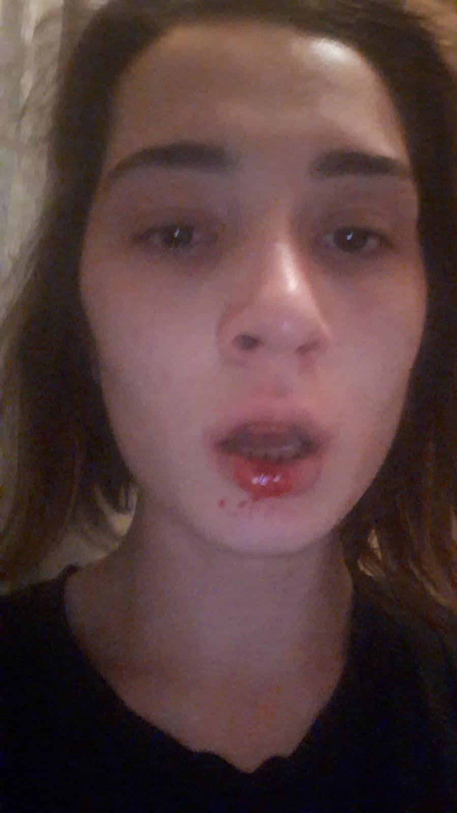 Eşinin amcası tarafından darbedilen kadın sosyal medyadan yardım istedi