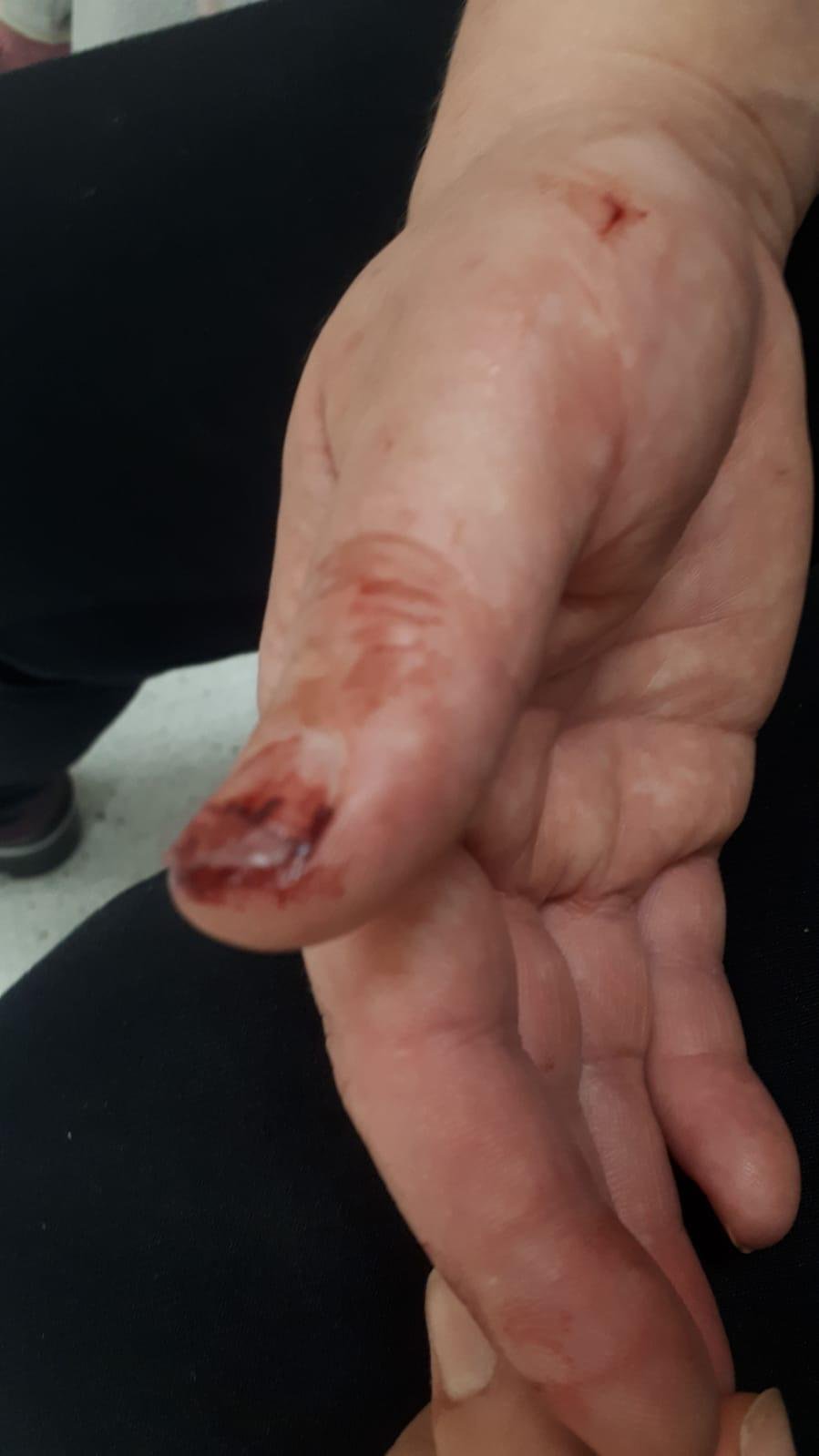 Eşinin amcası tarafından darbedilen kadın sosyal medyadan yardım istedi