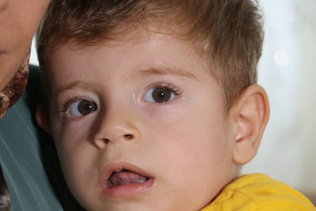 SMA hastası Alperen için gerekli yardımın sadece yüzde1'i toplandı