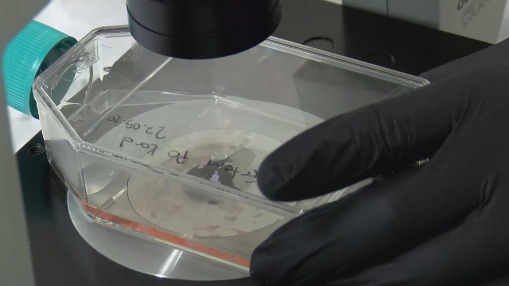 Ölümcül koronavirüs hastalarına yeni tedavi yöntemi: Yeni doğan göbek kordon kanı