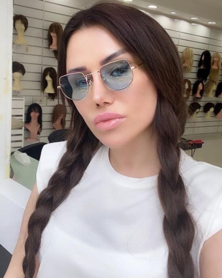 Şarkıcı Ceylan'ın son hali görenleri şaşırttı! Ceylan estetik mi yaptırdı?