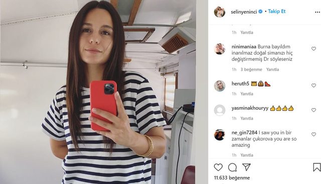 Bir Zamanlar Çukurova'nın güzel oyuncusu Selin Yeninci burun estetiği yaptırdı!