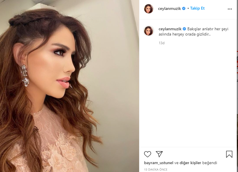 Şarkıcı Ceylan'ın son hali görenleri şaşırttı! Ceylan estetik mi yaptırdı?