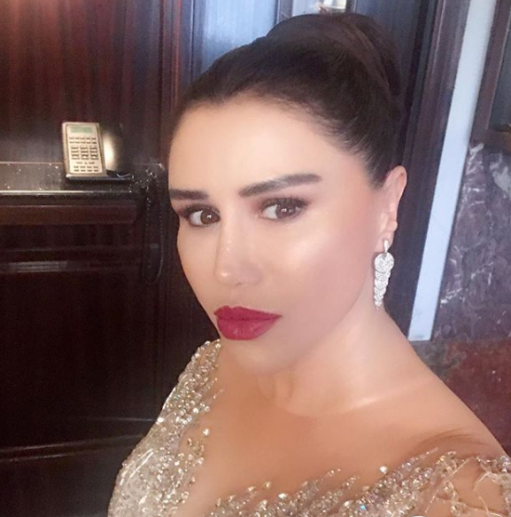 Şarkıcı Ceylan'ın son hali görenleri şaşırttı! Ceylan estetik mi yaptırdı?