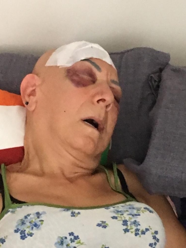 Kaynanasına ateş eden Ümit Akıncı'ya 8 yıl hapis!