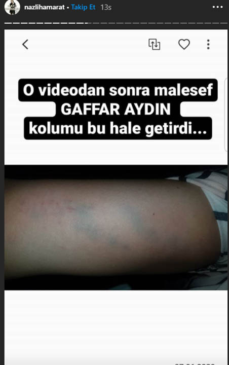 Nazlı Hamarat'ın eski sevgilisi Aydın Gaffar şok açıklamalarda bulundu!