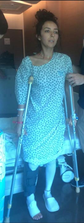 Düğünde bacağına havaifişek saplanan kadın sakat kaldı!