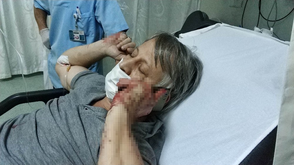 16 yaşındaki çocuk tartıştığı babasını bıçakla yaraladı