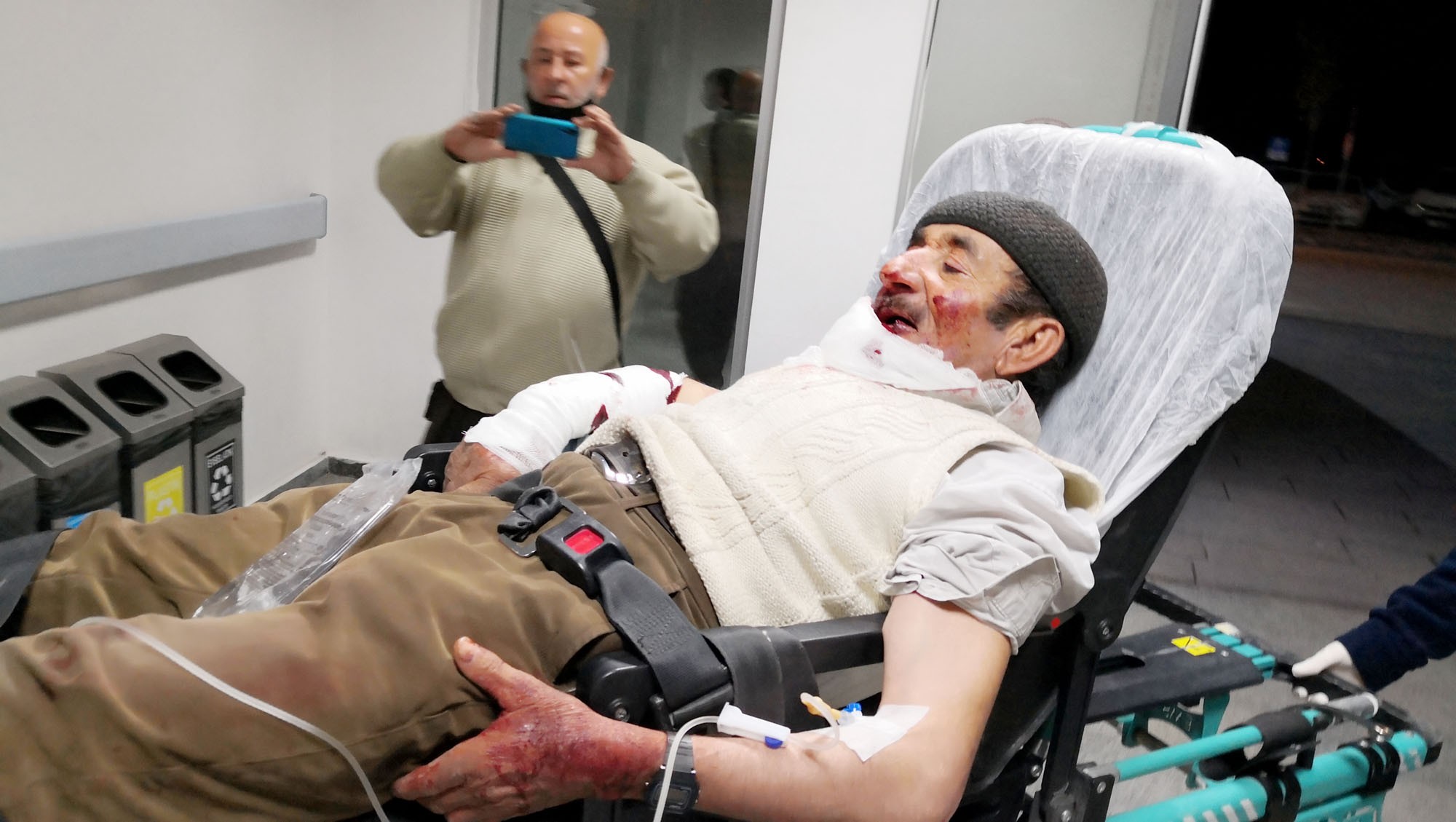 Misafir olarak gittiği evde köpek dehşeti yaşattı! Yüzünü ve vücudunu paramparça etti