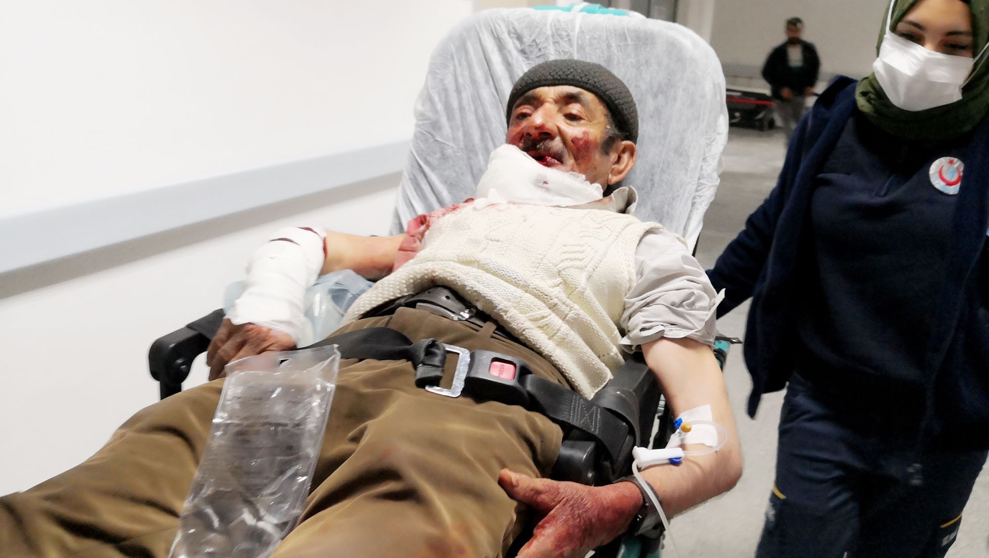 Misafir olarak gittiği evde köpek dehşeti yaşattı! Yüzünü ve vücudunu paramparça etti