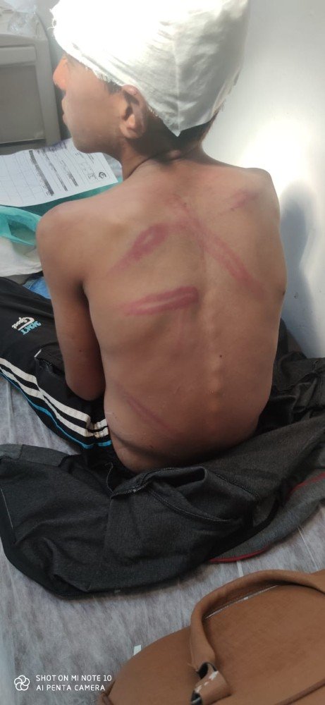 10 yaşındaki çocuğu öldüresiye dövdü