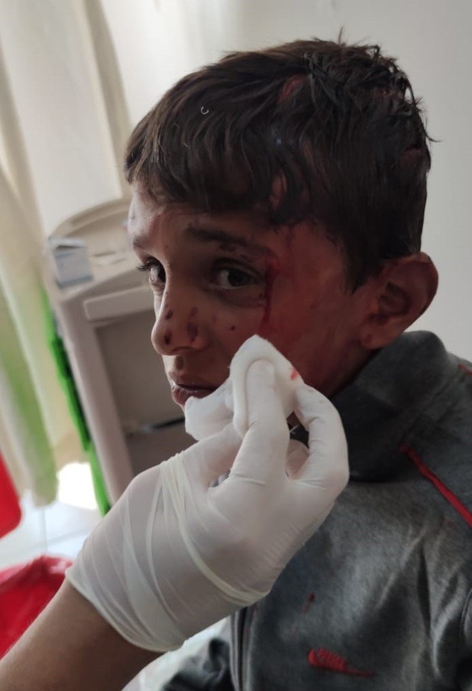 10 yaşındaki çocuğu öldüresiye dövdü