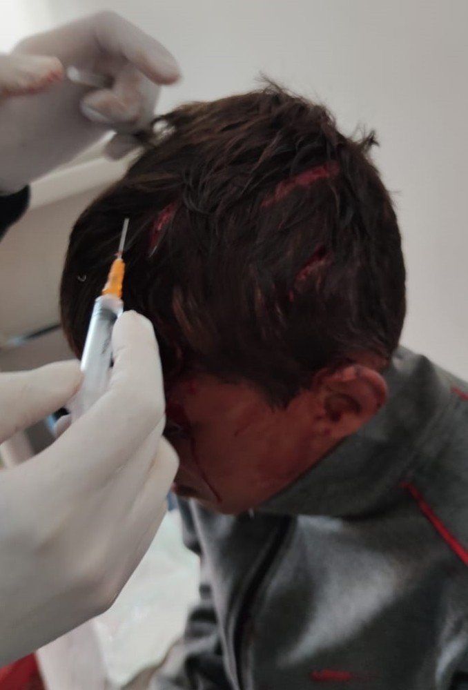 10 yaşındaki çocuğu öldüresiye dövdü