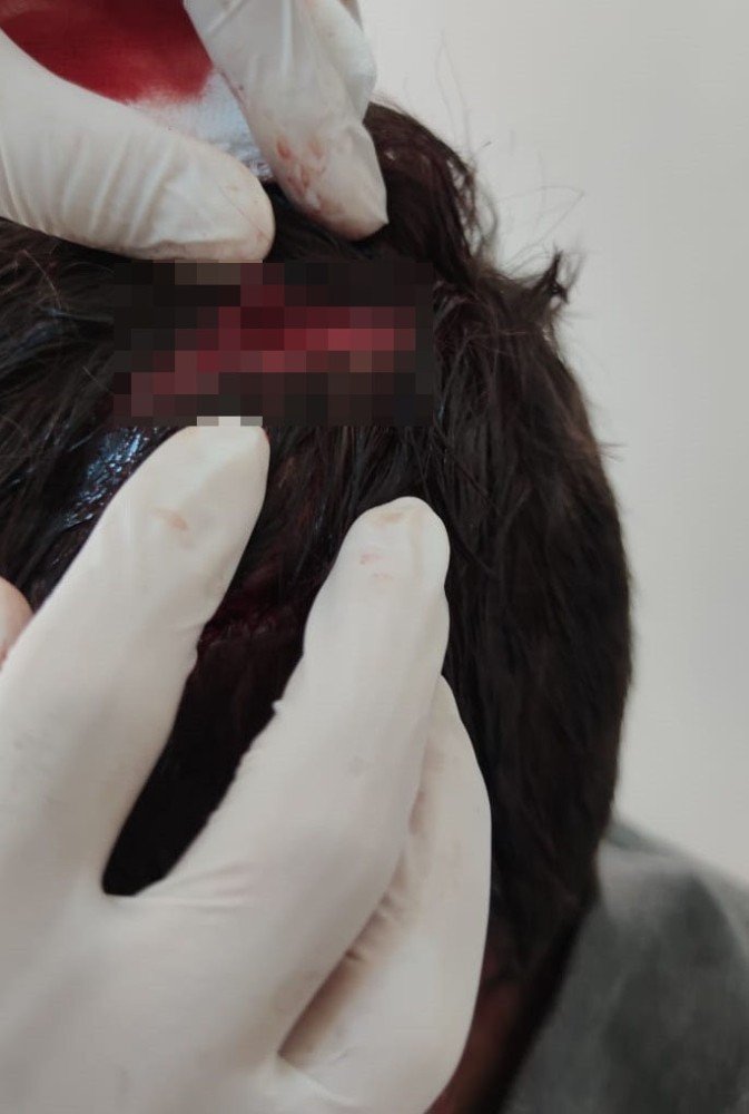 10 yaşındaki çocuğu öldüresiye dövdü