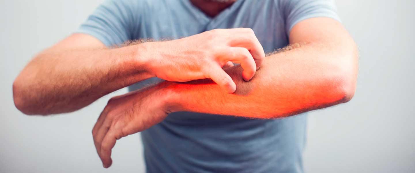 Siroz hastalığı nedir? Neden olur? | Siroz belirtileri, tedavisi, evreleri ve çeşitleri