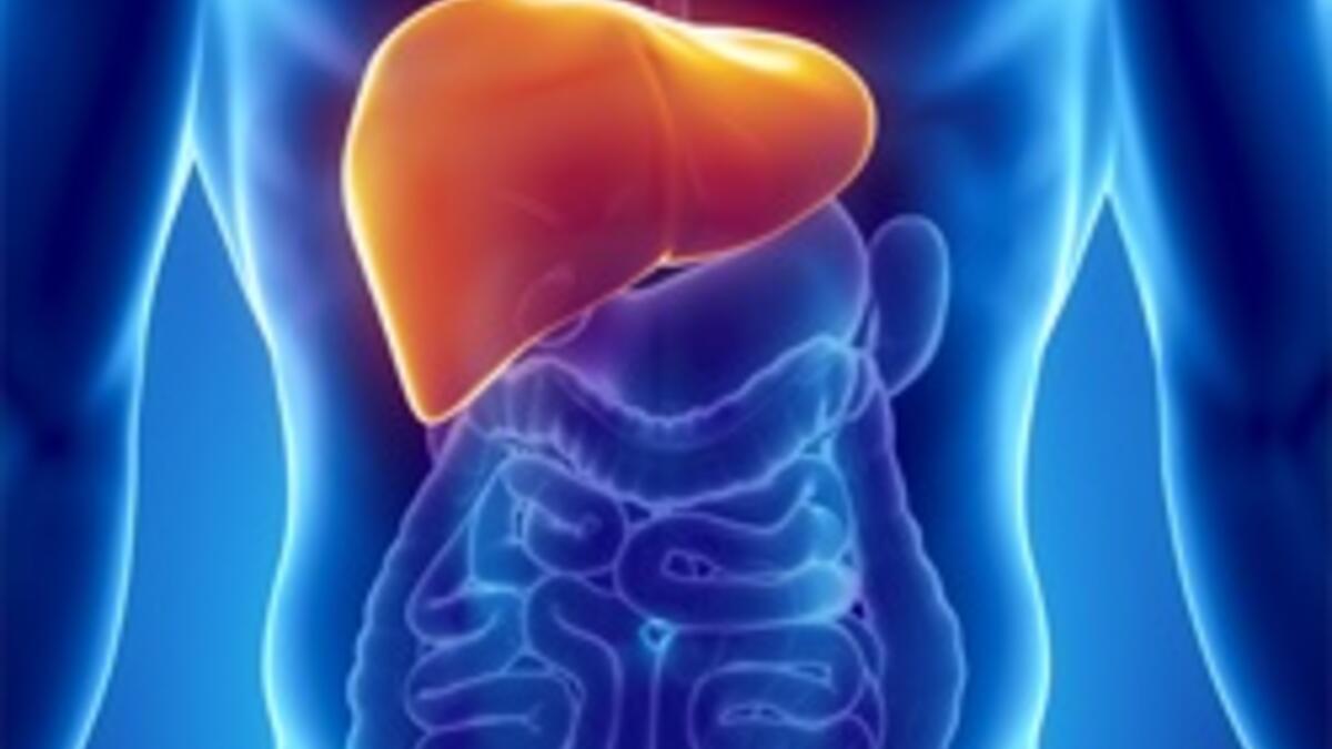 Siroz hastalığı nedir? Neden olur? | Siroz belirtileri, tedavisi, evreleri ve çeşitleri