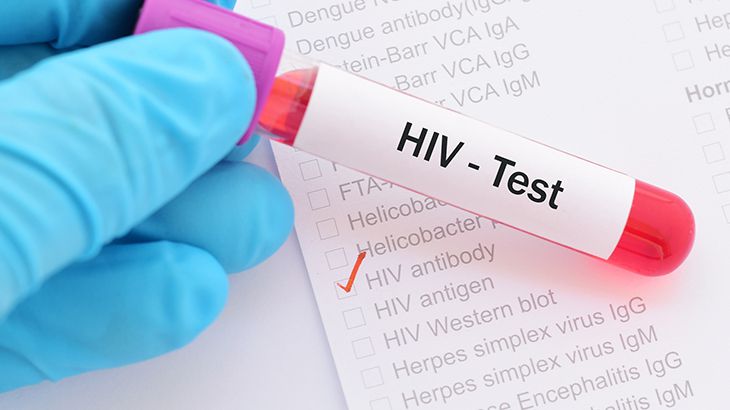 Aids Hastalığı Nereden Çıkmıştır?