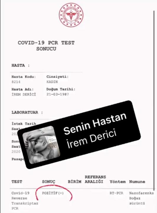İrem Derici'den kötü haber! Test sonucu pozitif çıktı