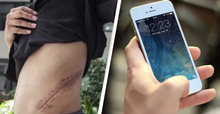 İPhone alabilmek için böbreğini satan genç hayatının hatasını yaptı!