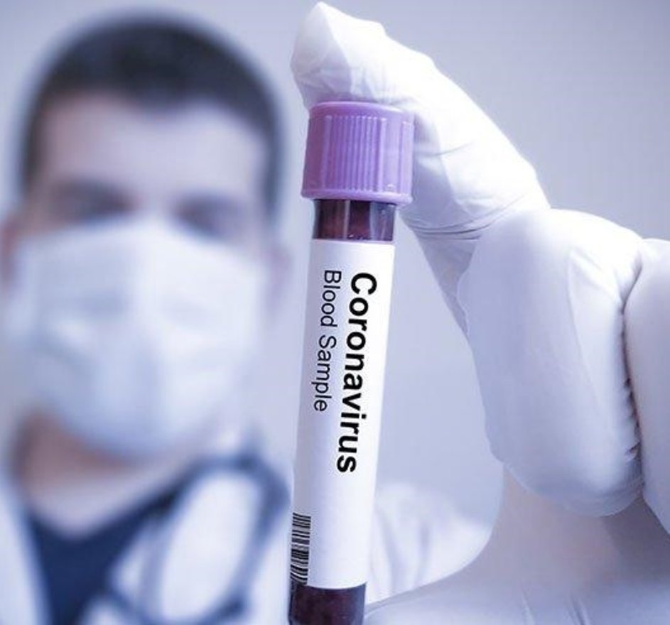 Özel hastanede covid testi iade ücreti nasıl alınır? Özel hastane korona testi ücreti