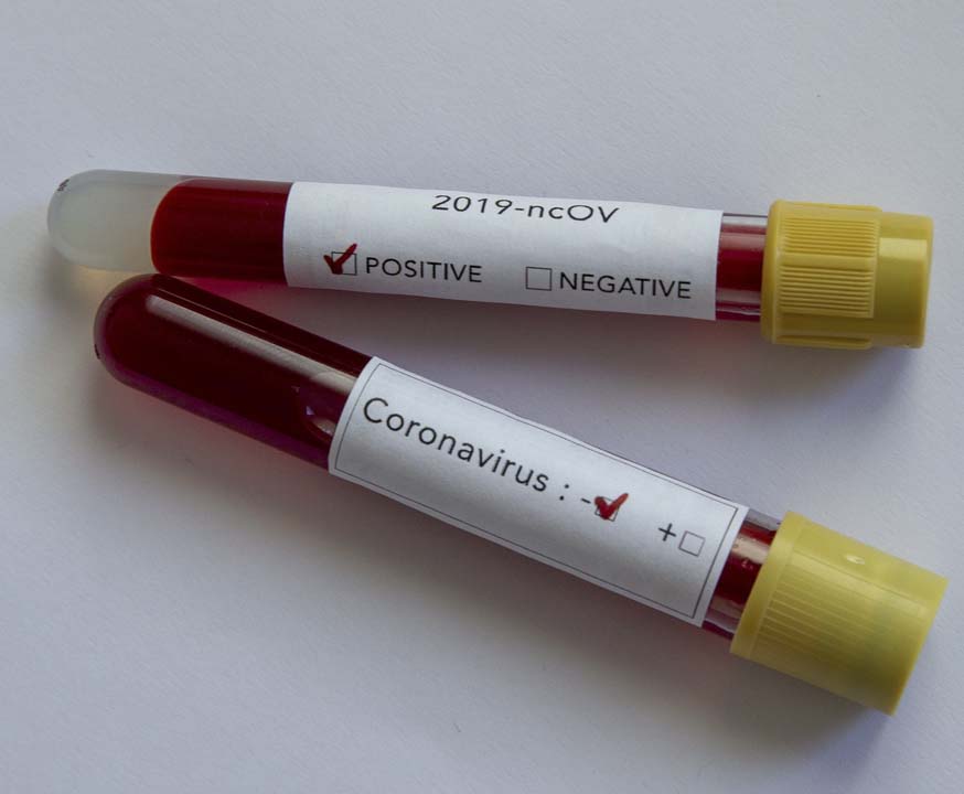 Prof. Dr. Tayfun Özçelik açıkladı: Koronadan en çok erkekler ölüyor