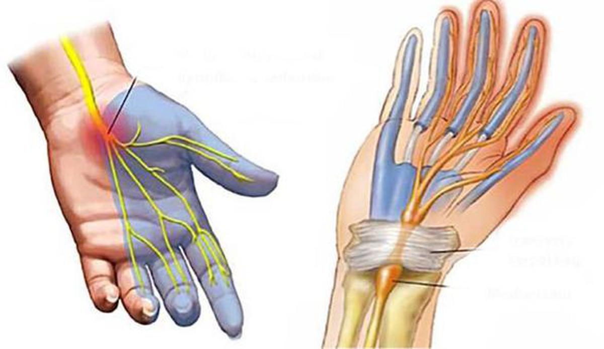 Raynaud hastalığı nedir? Belirtileri nelerdir? Tanısı nasıl konulur? Nasıl tedavi edilir? 