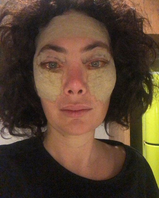 Akasya Asıltürkmen: Bu acıyı çekeceğimi bilsem yaptırmazdım