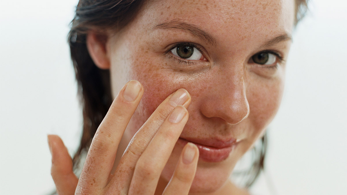 Güneş lekeleri nasıl geçer, neden olur, nasıl giderilir, nasıl çıkar? Güneş lekelerine ne iyi gelir, krem, maske, sabun