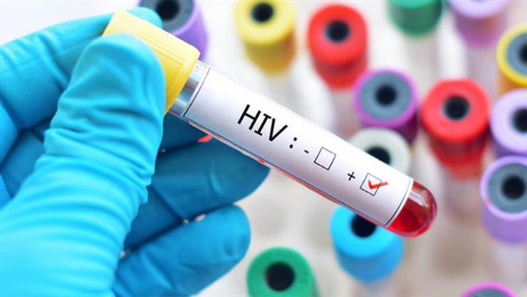 AIDS nedir? Belirtileri nedir, nasıl bulaşır ? Tedavi yöntemleri ve korunma yolları nelerdir?