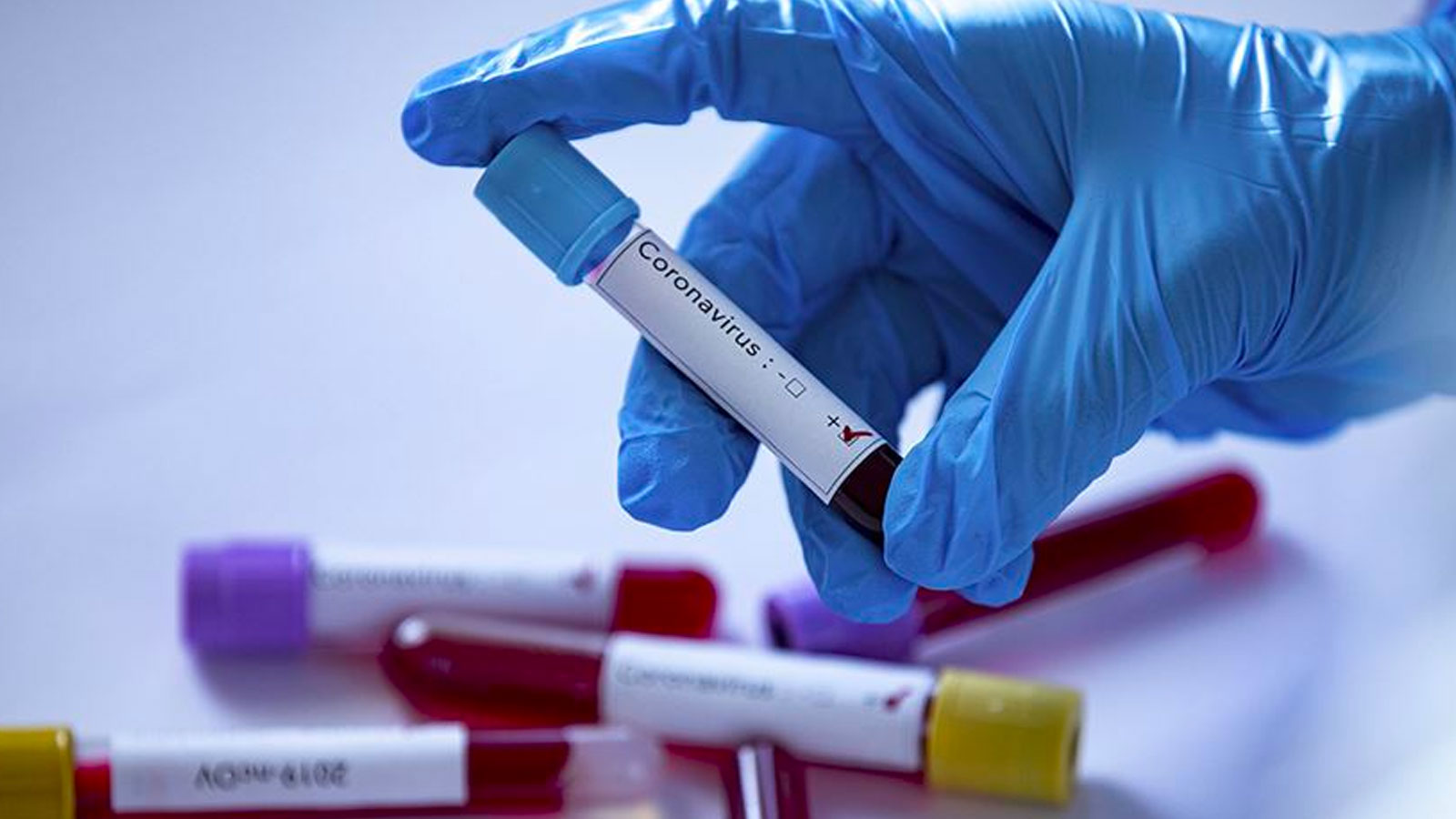 Koronavirüs ishal yapar mı? Koronavirüs ishali nasıl olur? Koronavirüs ishal belirtisi, rengi