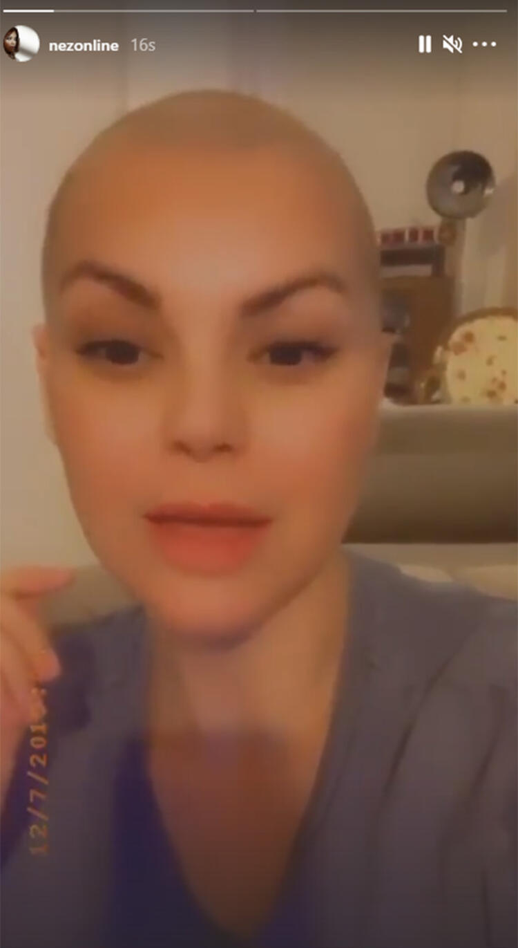 Şarkıcı Nez'in son hali görenleri şaşkına çevirdi! Nez saçlarını sıfıra vurdu!