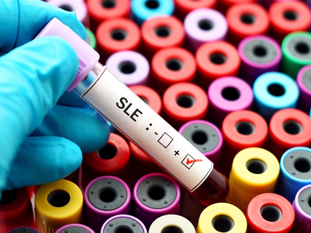 Milli tekvandocu Gamze Özdemir, kelebek hastalığına yenildi