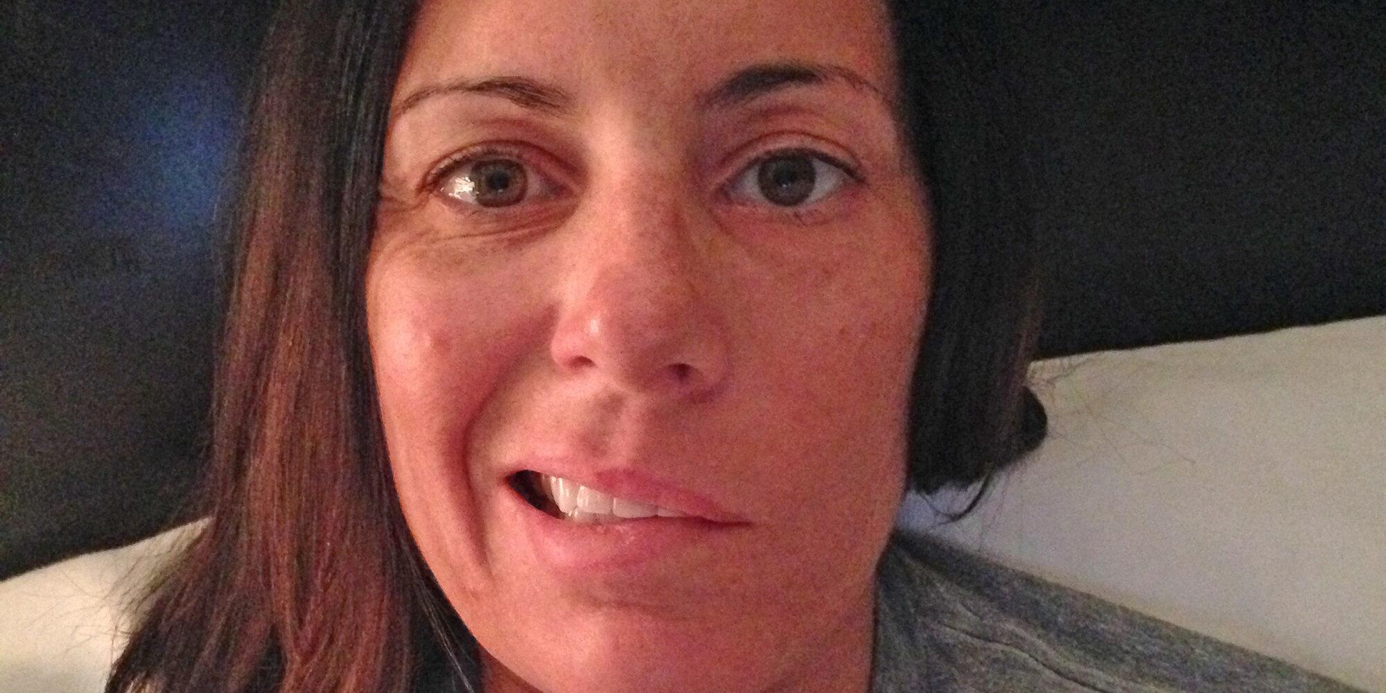 Yüz felci nedir? Neden olur? Kaç günde geçer? | Yüz felci belirtileri, tedavisi, duası 