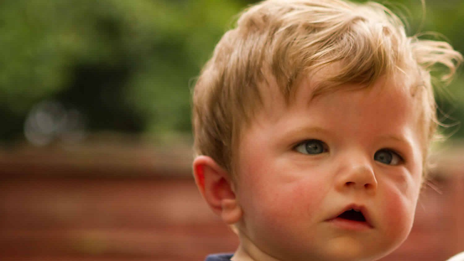 Yüz felci nedir? Neden olur? Kaç günde geçer? | Yüz felci belirtileri, tedavisi, duası 