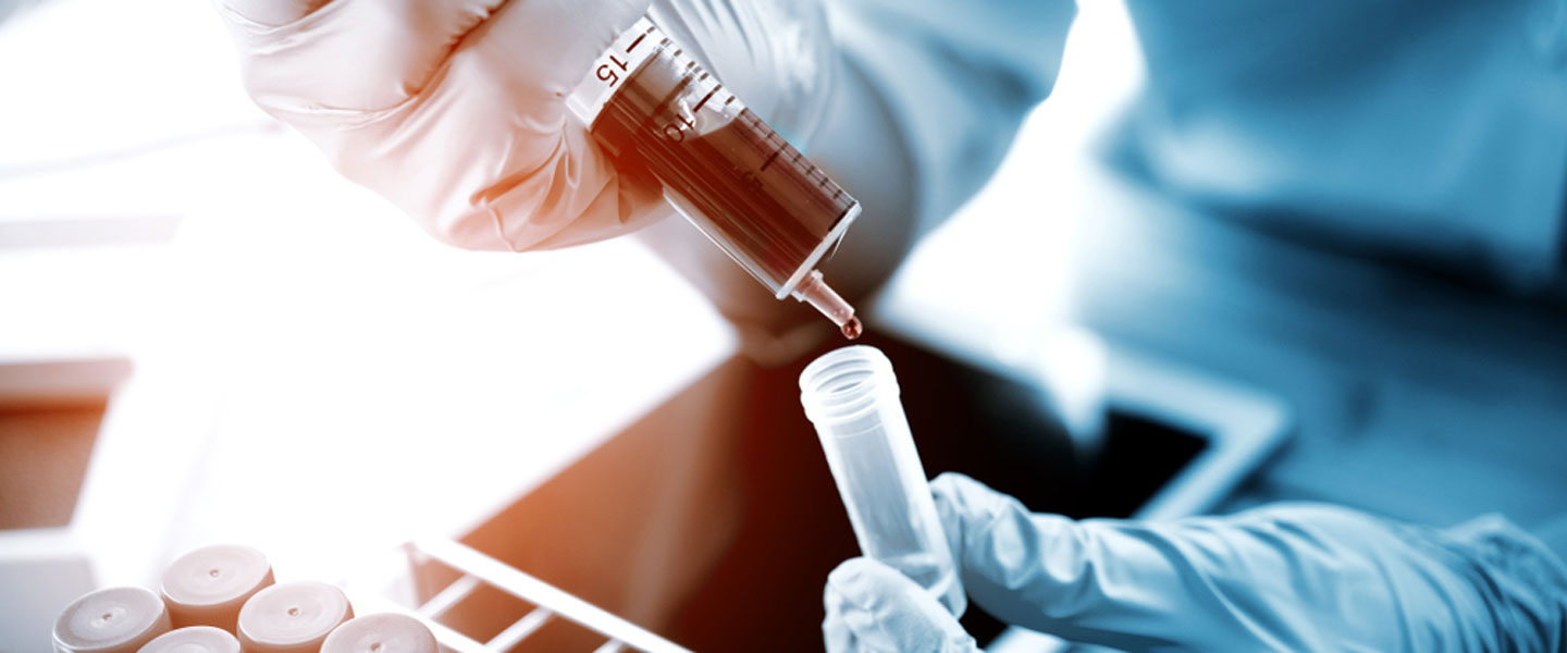 İmmün plazma nedir? Nasıl verilir? İmmün Plazma bağışı şartları, zararları nelerdir? Kimler verebilir?