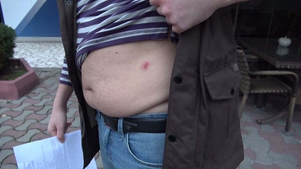 Testi pozitif çıkan doktor, kocasını darp etti, yüzüne tükürerek virüs bulaştırmaya çalıştı