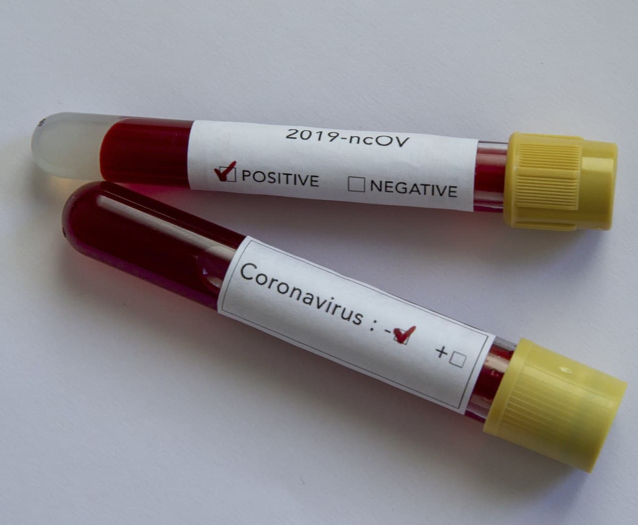 DSÖ'den yürekleri ferahlatan açıklama: Mutant virüs, evrimin bir parçası