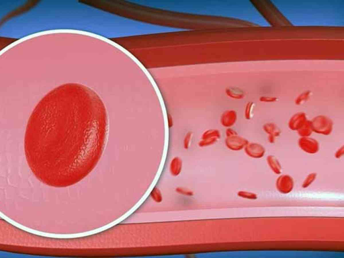 Eritrosit nedir? İdrarda eritrosit neden olur? Belirtileri nelerdir?