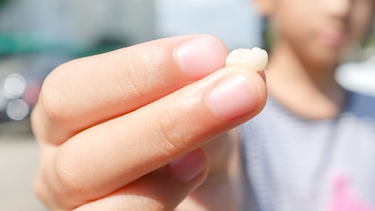 Rüyada Dişlerin Tamamının Döküldüğünü Görmek Tabiri