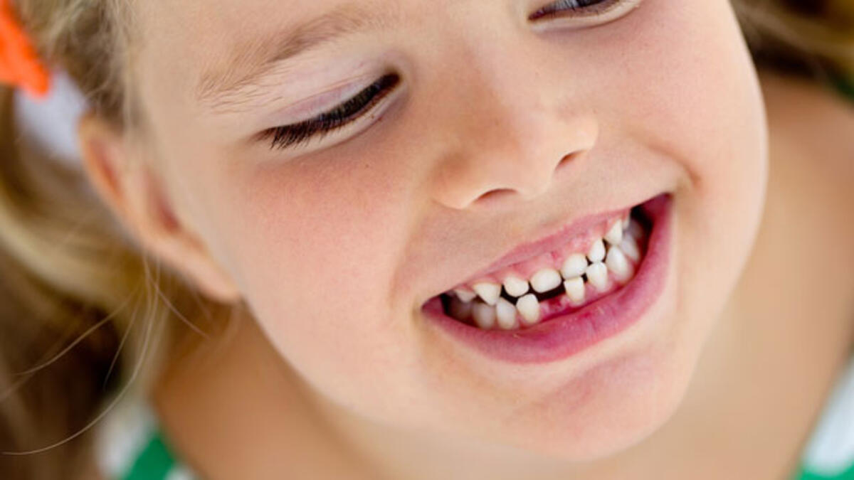 Rüyada Dişinin Çıkması / Rüyada Dişinin Çıktığını Görmek Tabiri