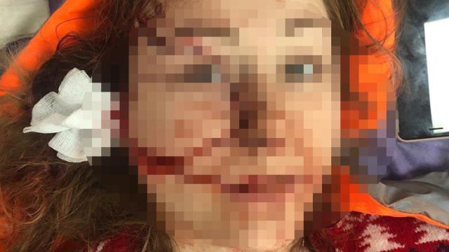 Kocaeli’nde yaşayan Ukraynalı Anna Butim’e eski eşi Mesut Öztürkmen falçatalı saldırı!