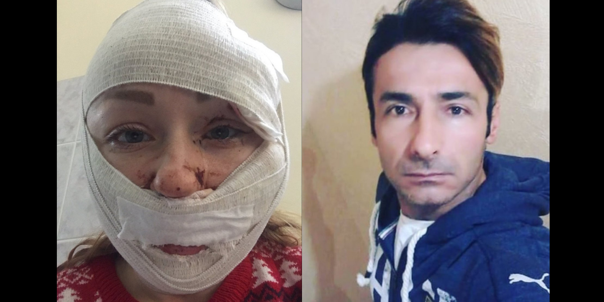 Kocaeli’nde yaşayan Ukraynalı Anna Butim’e eski eşi Mesut Öztürkmen'den falçatalı saldırı!