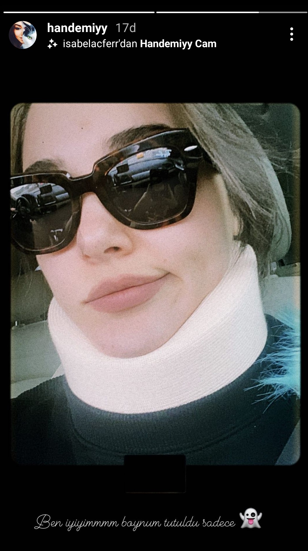 Hande Erçel'in o hali sevenlerini korkuttu!