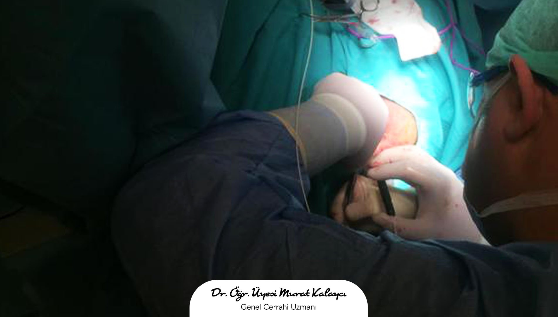 Basur nedir? Basur nasıl geçer? Basura ne iyi gelir? Basur ağrısı evde geçer mi?