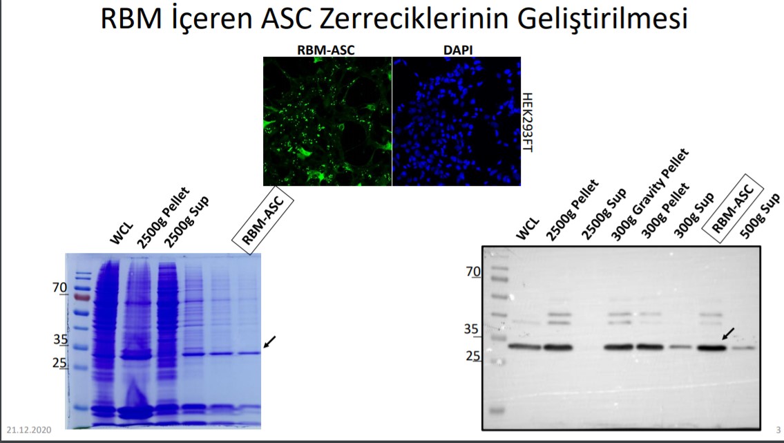 ASC zerrecik aşısı nedir? Ne işe yarar? | ASC zerrecik teknolojisi nasıl tedavi ediyor?