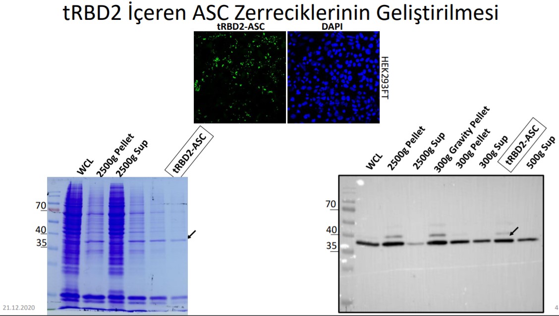 ASC zerrecik aşısı nedir? Ne işe yarar? | ASC zerrecik teknolojisi nasıl tedavi ediyor?
