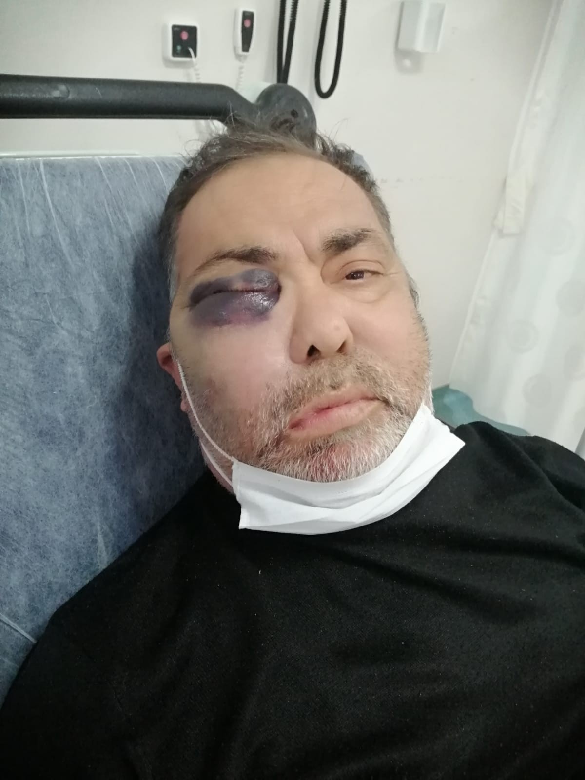 Antalya'da yüzde 90 engelli adamı öldüresiye darp ettiler