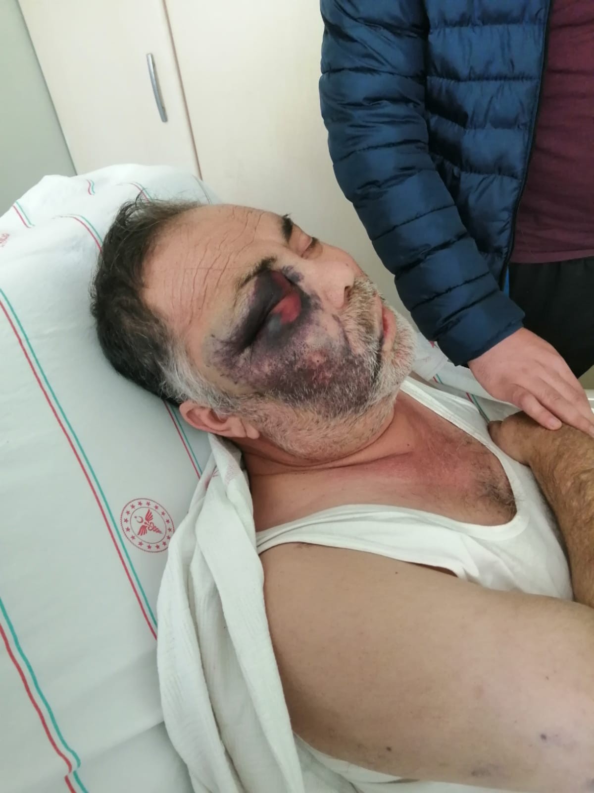 Antalya'da yüzde 90 engelli adamı öldüresiye darp ettiler