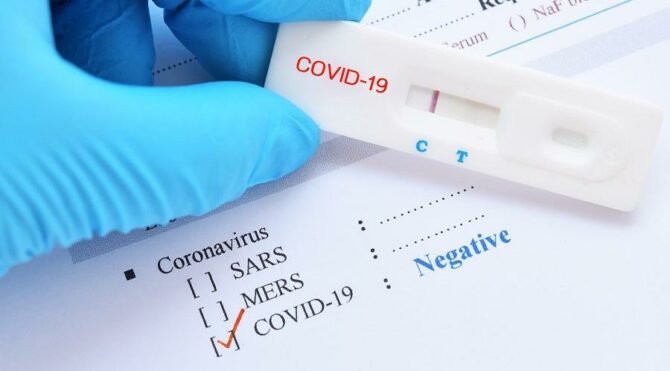 Sahte Kovid-19 negatif test sonucu satan şebeke çökertildi!