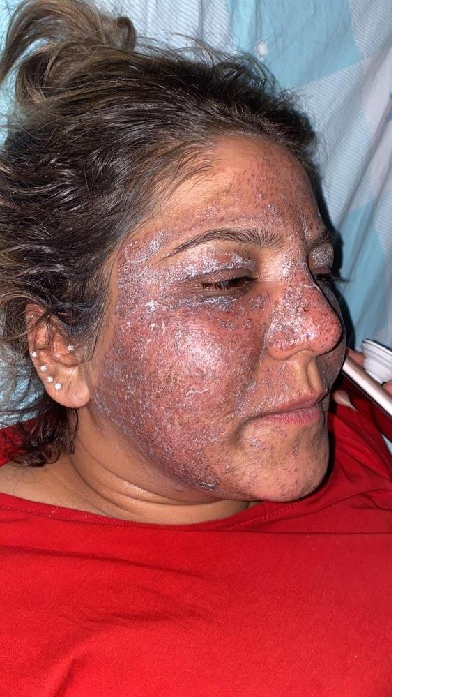 Güzellik merkezine gitti güzelliğinden oldu!